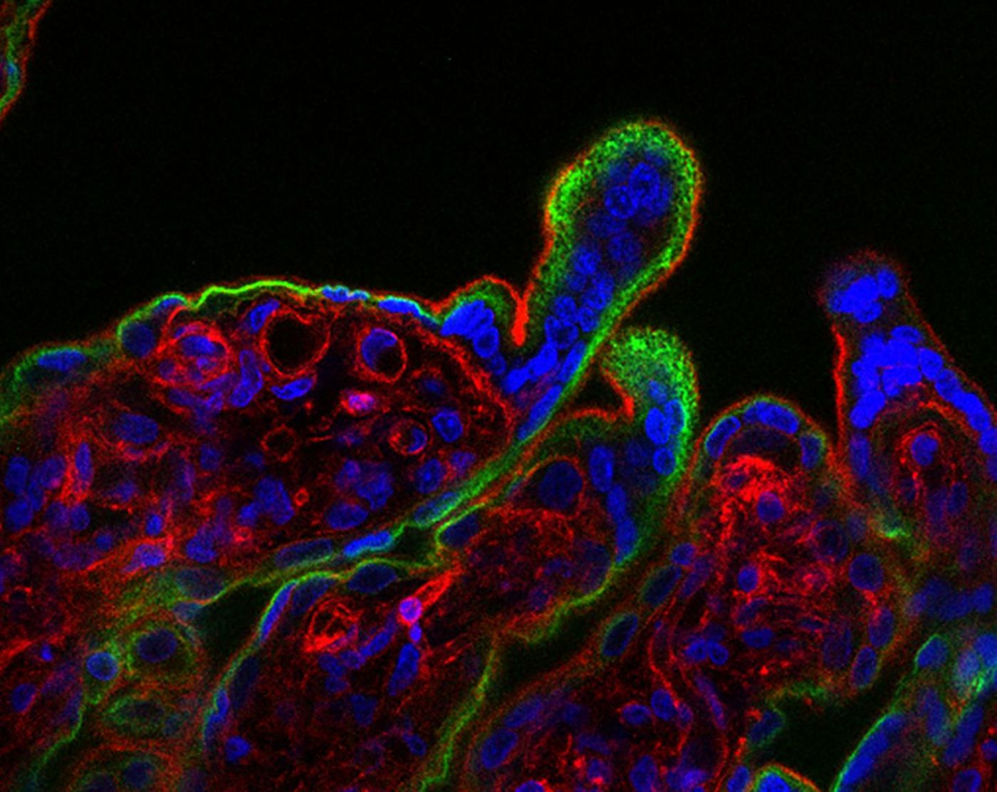 When human placental tissue (fluorescence microscopy image shown) is exposed to interferon-β, it develops syncytial knots. Credit: Yockey et al., Science Immunology (2018)
