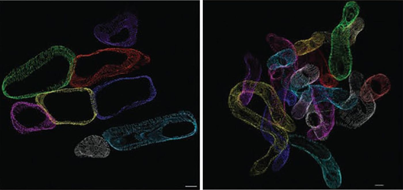 The image shows mitochondria from normal heart (left) and lipid overloaded heart (right). Excess fat results in more numerous, more contorted mitochondria. Credit: E. Dale Abel Lab, University of Iowa