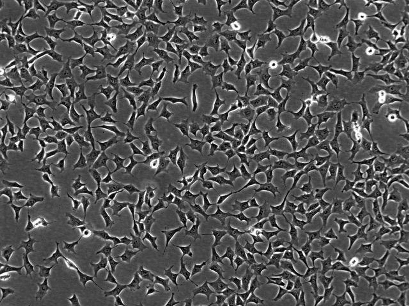 Mesenchymal arterial cells, which become more star-shaped and can pile up on one another, leading to a thickening or buildup in the arteries. Credit: Morgridge Institute for Research