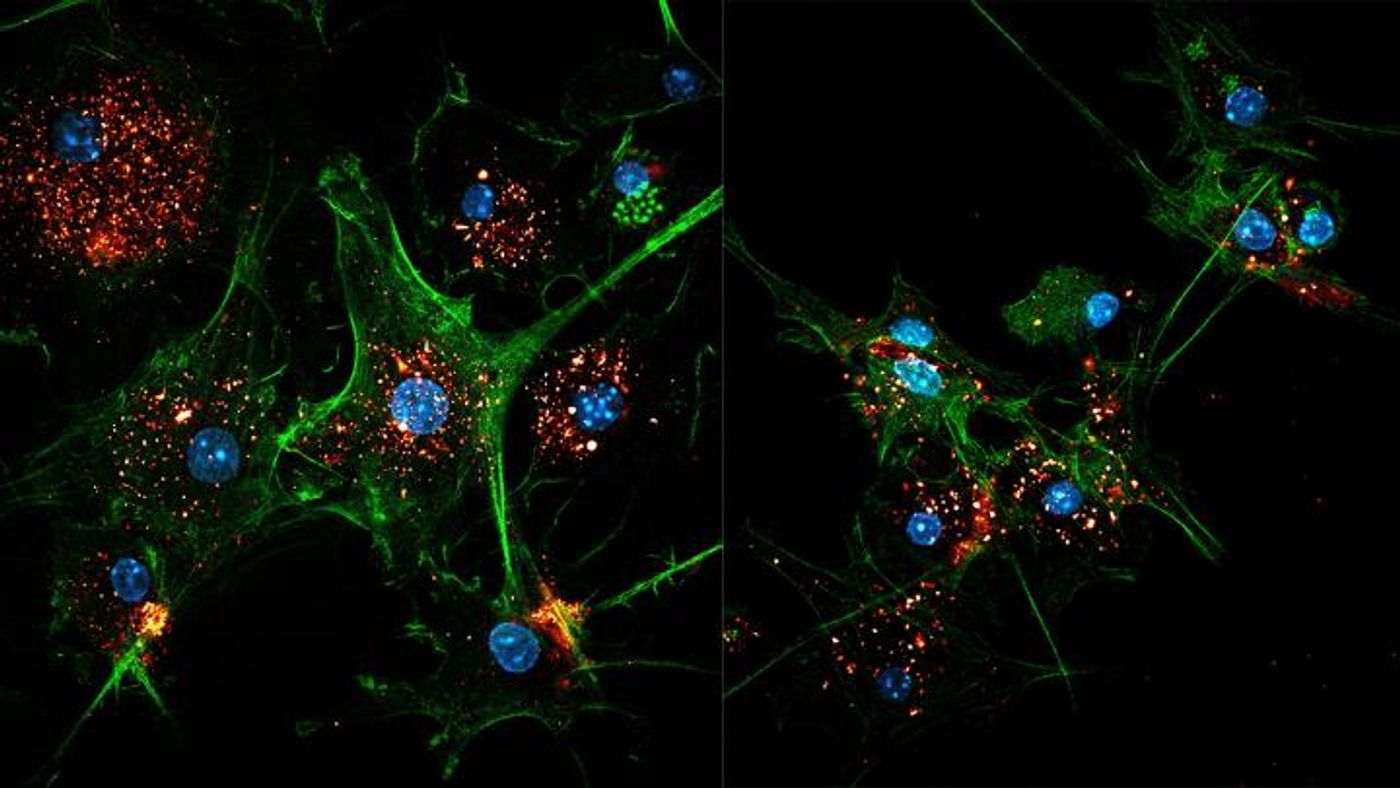 Two images of EVIR-engineered dendritic cells (green) capturing tumor antigens in exosomes (gold/red). Cell nuclei are colored blue. Credit: M. De Palma/EPFL