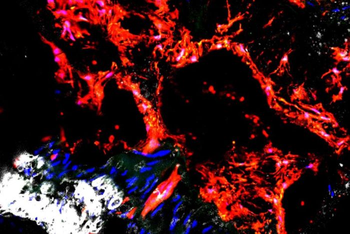  Gli1 cells (red) are responsible for depositing calcium in the arteries.