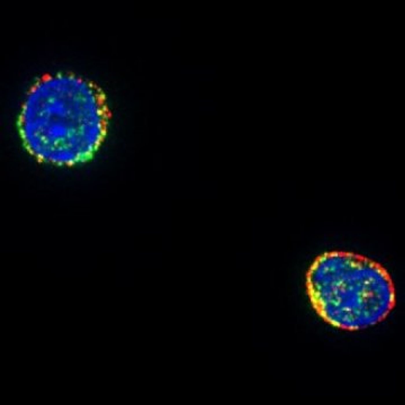 T cells from a HIV-infected patient were stained for HIV RNA (red), HIV protein (green) and the nucleus (blue)