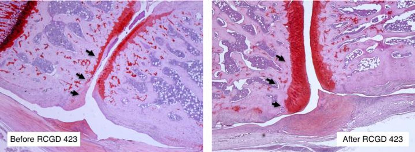 Osteoarthritis leads to the progressive loss of joint cartilage, shown in red. / Credit: Nancy Liu/Denis Evseenko Lab, USC