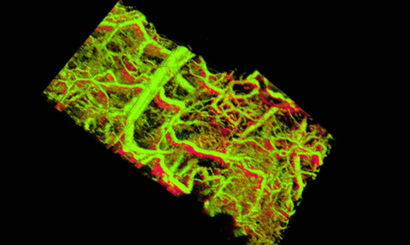 "We've been trying to look into the living body and see information at the level of the single cell," says Adam de la Zerda. "Until now there has been no way do that." Above: Gold nanorods within the blood vessels of a mouse ear appear green. The lower right shows vessels within a tumor that lies under the skin.