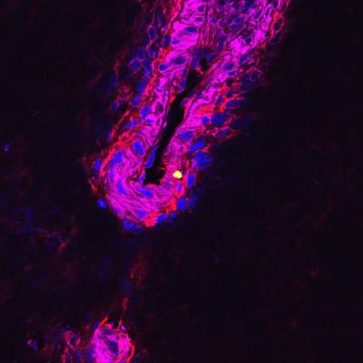 This is an image of a cluster of pneumococcal cells replicating. / Credit: University of Leicester