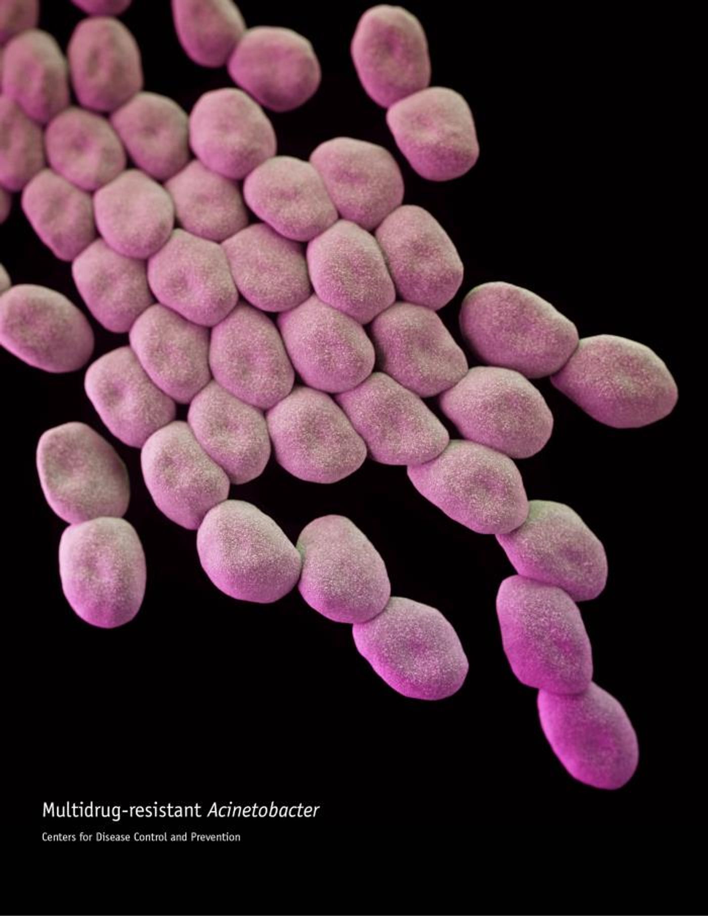 A computer-generated illustration of a group of multidrug-resistant Acinetobacter sp. bacteria,s based upon scanning electron microscopic (SEM) imagery. / Credit: CDC/ Antibiotic Resistance Coordination and Strategy Unit / James Archer - Medical Illustrator