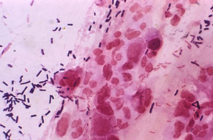 A photomicrograph of a Gram-stained vaginal smear specimen, revealing normal bacterial flora, including Gram-positive lactobacilli, and smaller, Gram-negative, pink-stained bacilli. Vaginal epithelial cells are also present / Credit: CDC/ Joe Miller