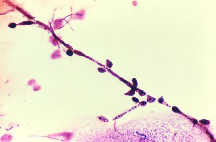 Candida albicans. / Credit: CDC/ Dr. Stuart Brown