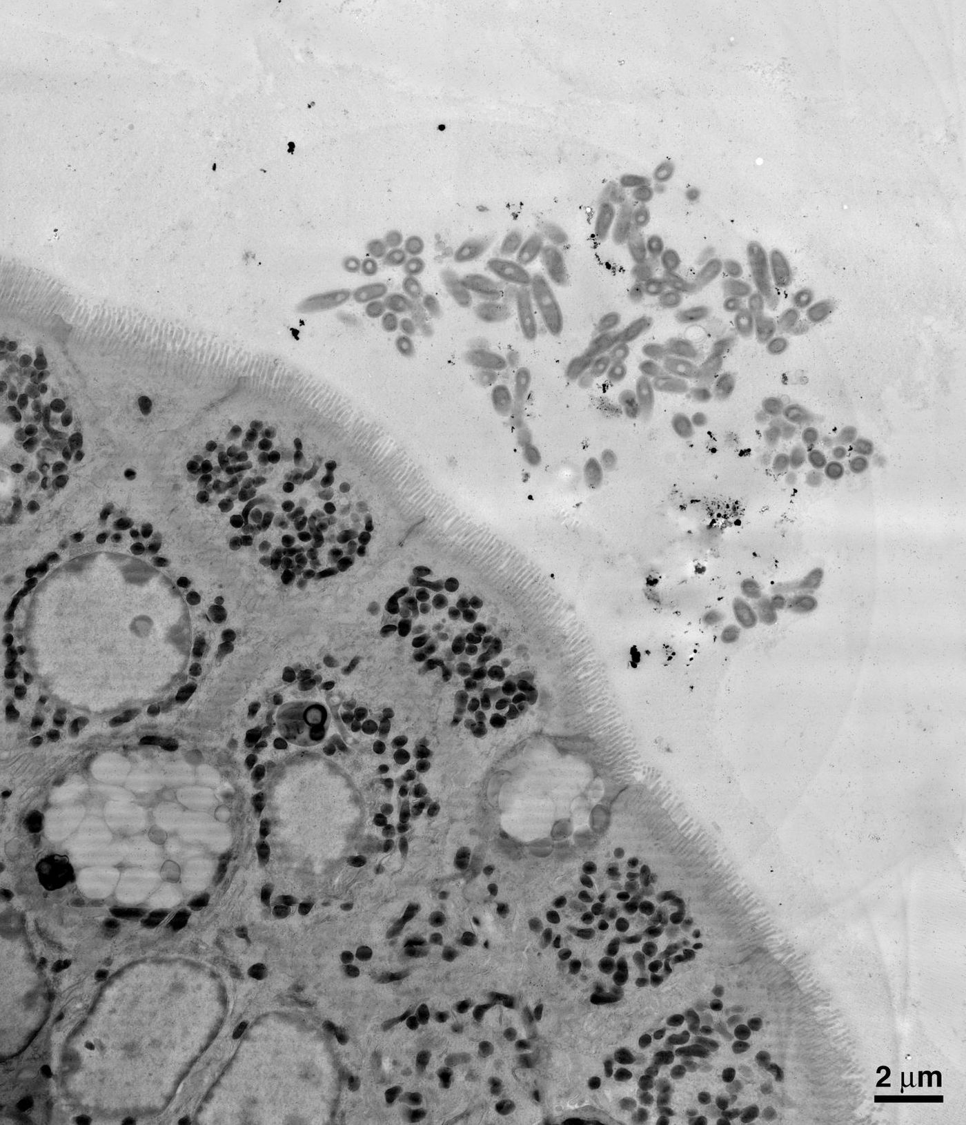 An electron microscopy image of a section of the mouse gut, showing B. fragilis aggregating close to the epithelial cells that make up the lining of the gut. / Credit: Courtesy of the Mazmanian laboratory