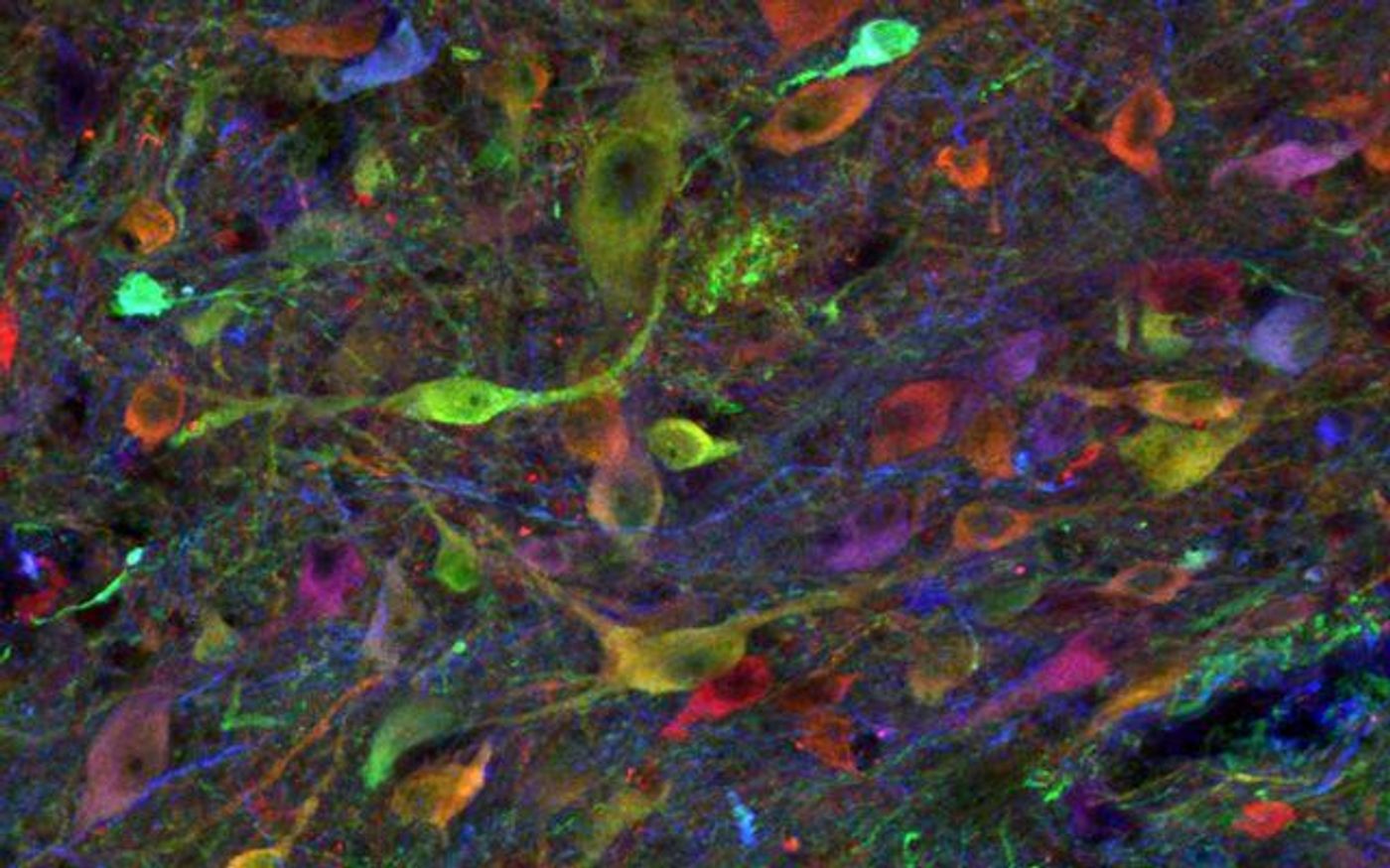 A population of induced pluripotent stem cell-derived neurons. Credit: UC San Diego Health