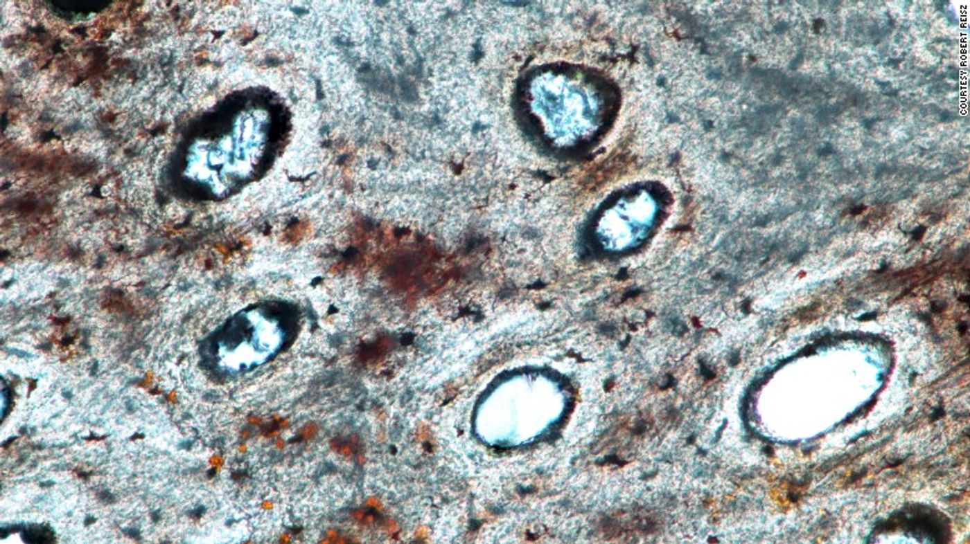 Vascular canals from the rib bone of the fossil.