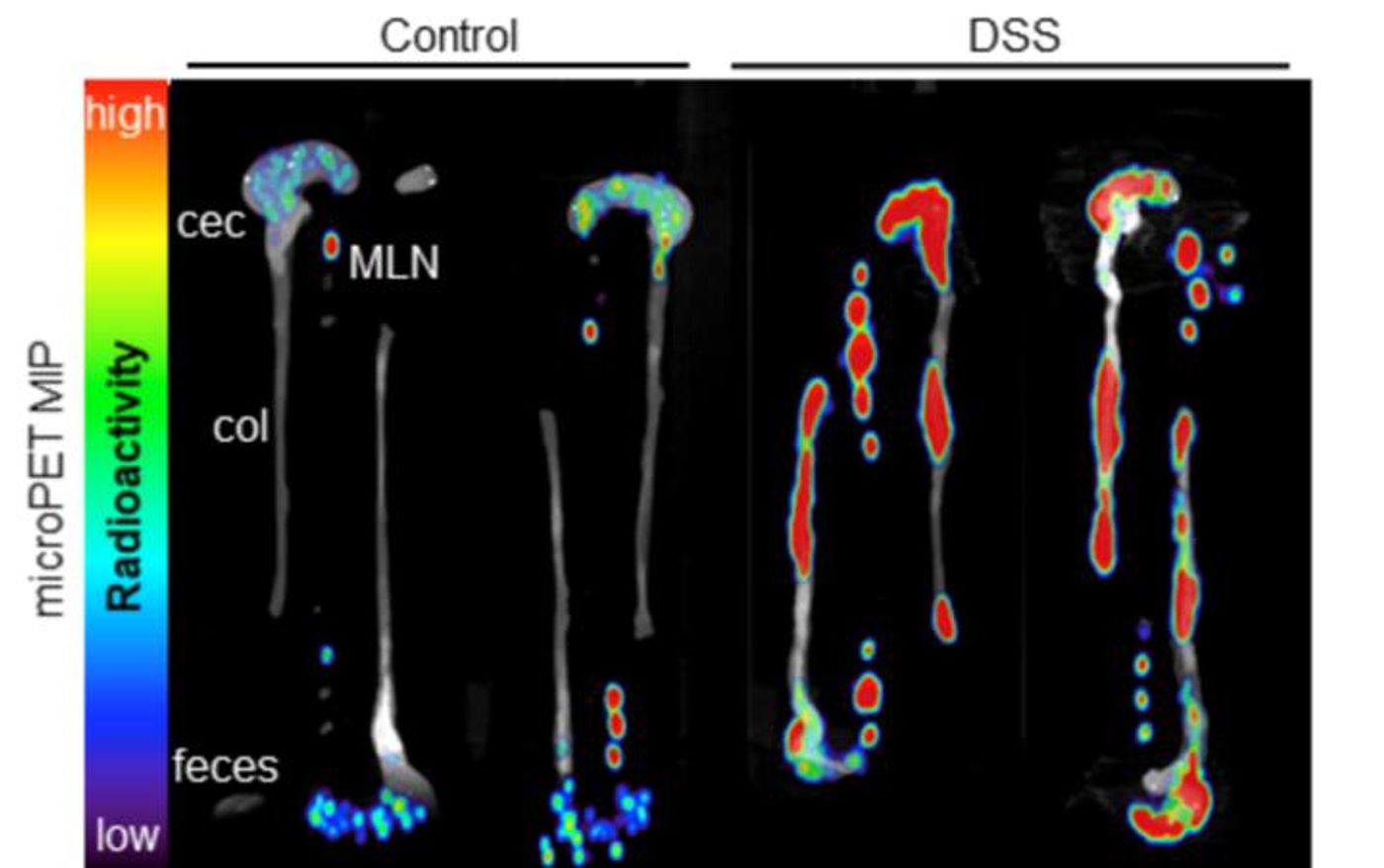 Ex vivo PET/CT scan. Credit: AC Freise et al., David Geffen School of Medicine, UCLA, Los Angeles, CA.