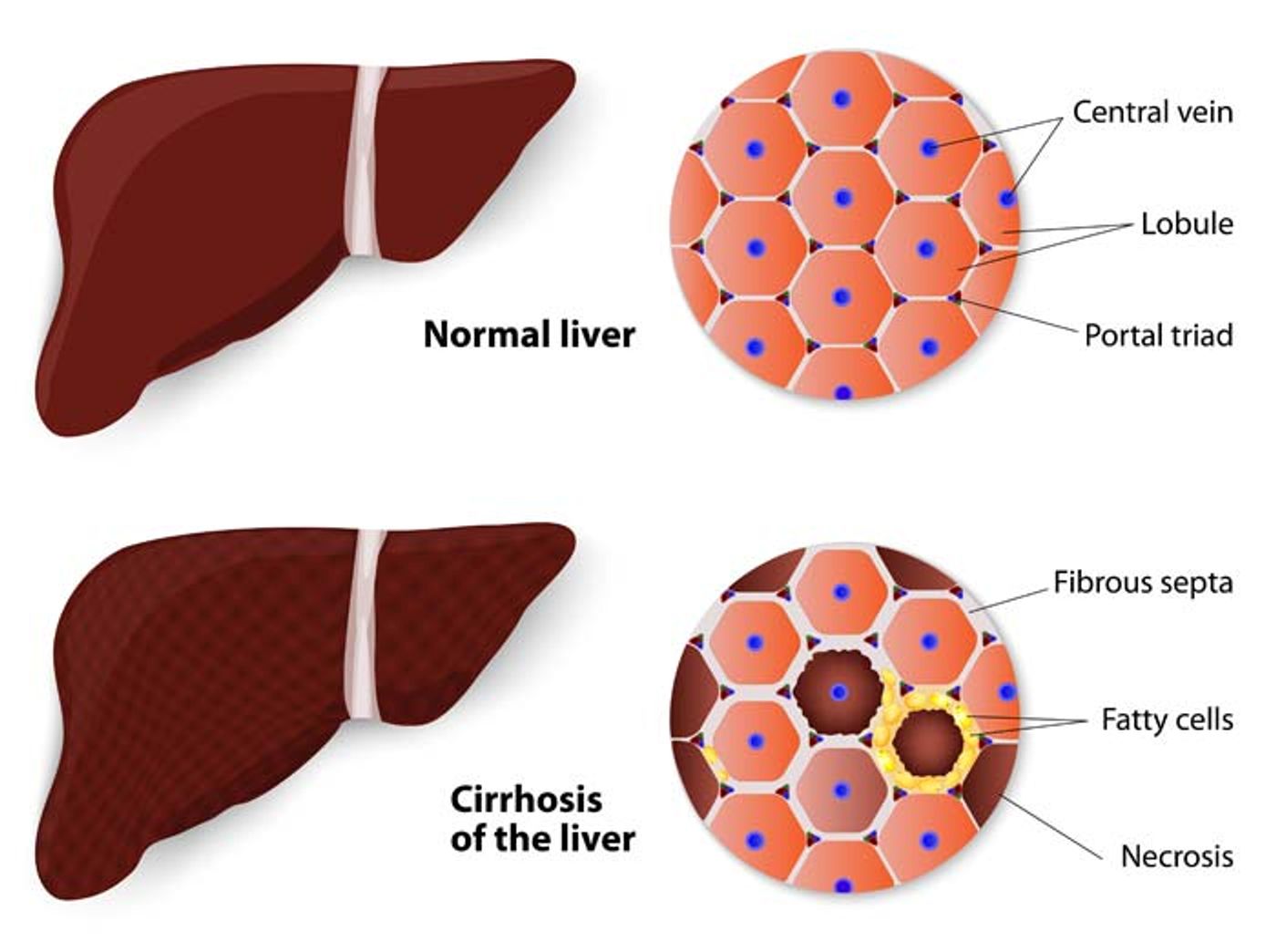 Image: Medical News Today