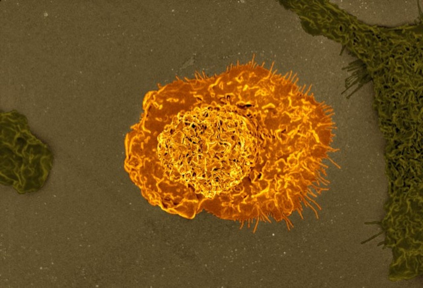 Macrophage  Colorized scanning electron micrograph of a macrophage. Credit: NIAID