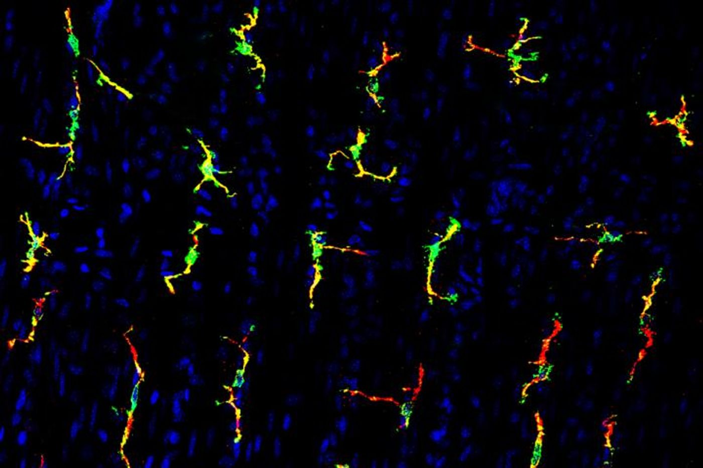 Macrophages trigger smooth muscle contractions in the GI tract. Credit: Center for the Study of Itch