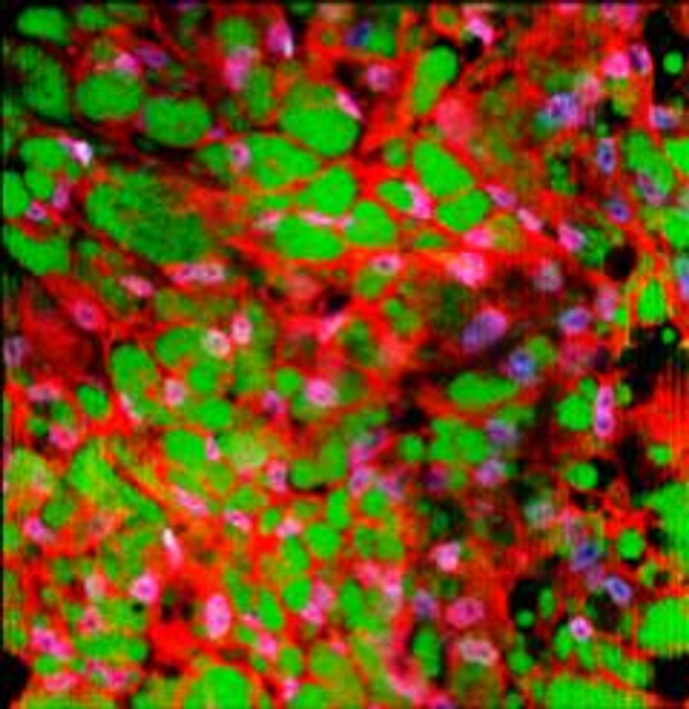 Human white adipose tissue cultured in browning media for three weeks and stained with UCP1 (red), Lipidtox (green), and Sytox nuclear stain (blue). / Credit:  Brian Gillette/Columbia Engineering