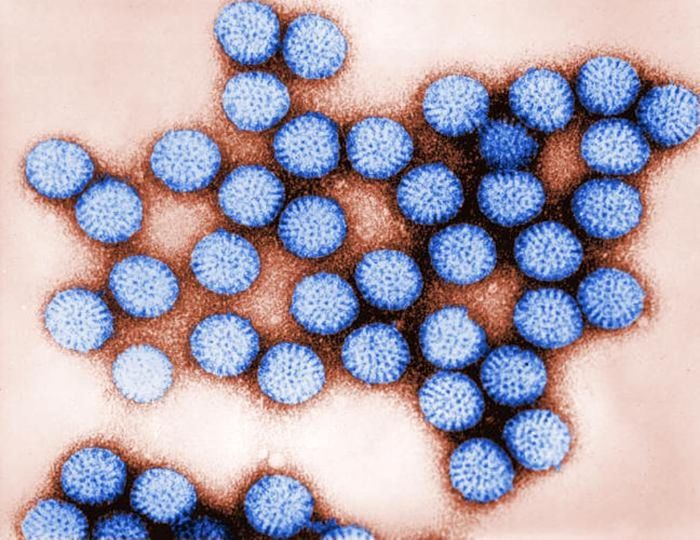 A TEM image of intact rotavirus / Credit: CDC/ Dr. Erskine Palmer