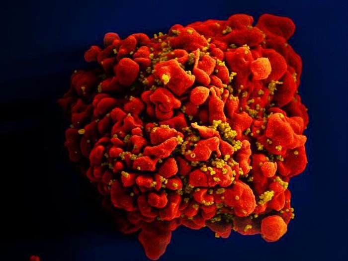 A digitally colorized SEM image of a (red) H9-T cell infected by numerous (mustard) HIV particles, which can be seen attached to the cell's surface membrane. / Credit: National Institute of Allergy and Infectious Diseases (NIAID)