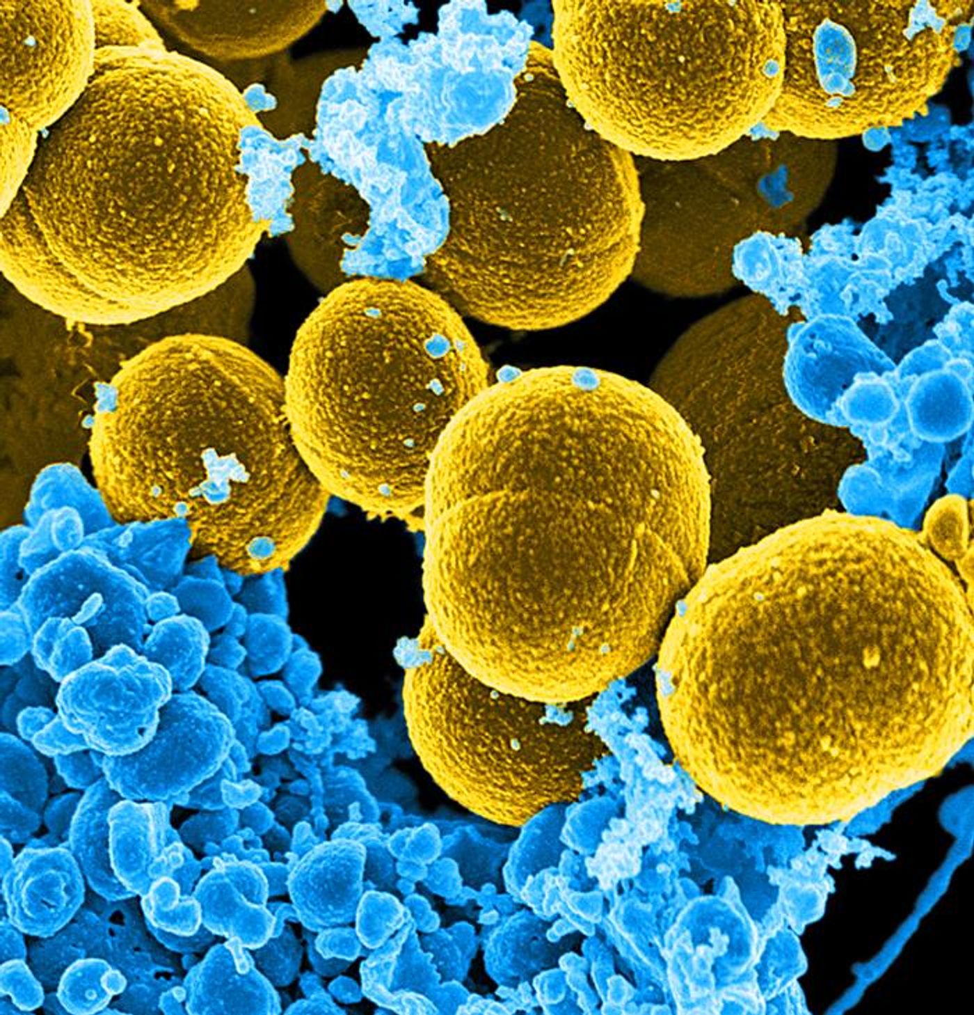 A digitally colorized, 20,000X SEM image, of mustard-colored Staphylococcus aureus bacteria,, attempting to escape their destruction by blue-colored, human white blood cells. /Photo Credit: Frank DeLeo, National Institute of Allergy and Infectious Diseases (NIAID)