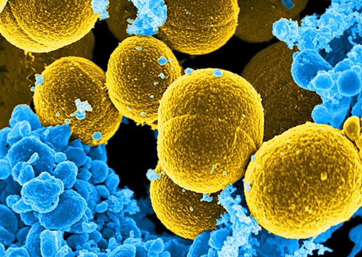 A (cropped) 20,000X magnification of a digitally colorized SEM image of Staphylococcus aureus bacteria (yellow) in the process of attempting to escape destruction by human white blood cells (blue). / Credit: Frank DeLeo, National Institute of Allergy and Infectious Diseases (NIAID)