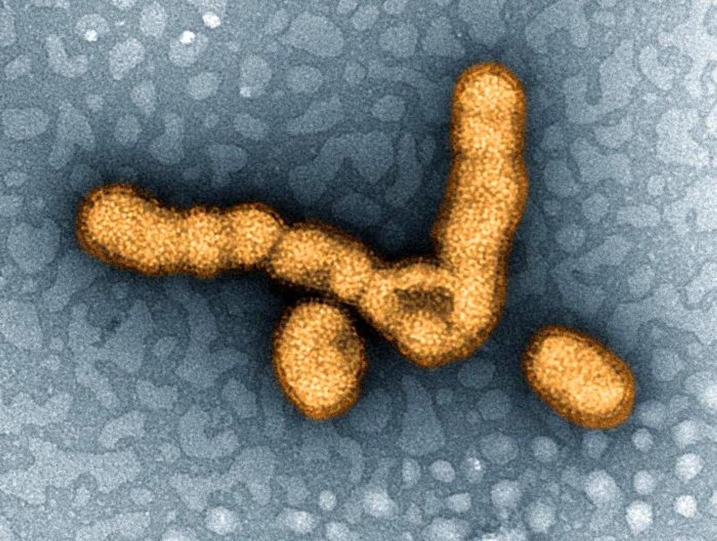 A digitally colorized TEM image depicting a small grouping of H1N1 influenza virus particles. / Credit: National Institute of Allergy and Infectious Diseases (NIAID)
