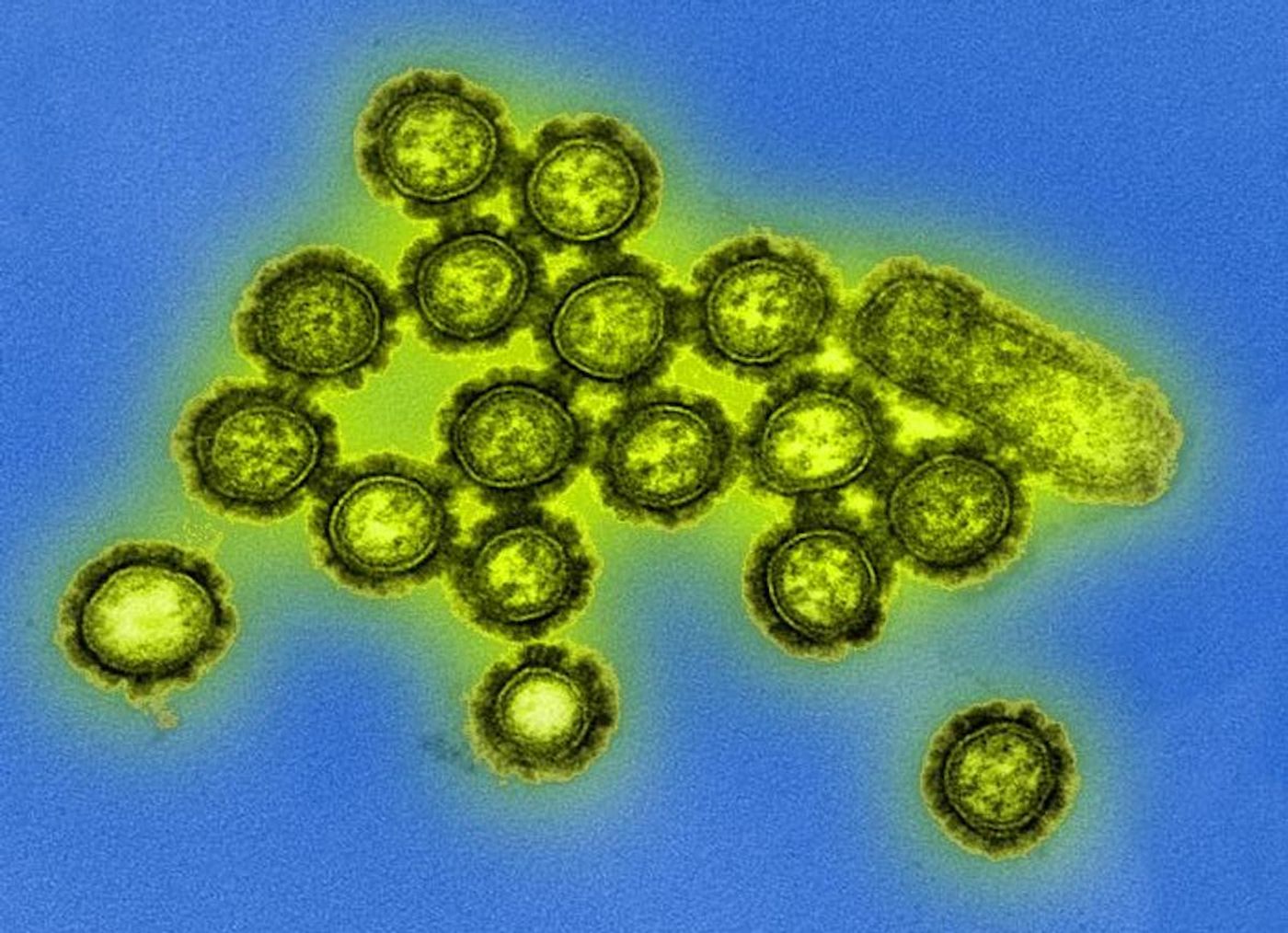 A digitally colorized TEM image depicting H1N1 influenza virus particles. Surface proteins located on the surface of the virus particles are shown in black. / Credit: National Institute of Allergy and Infectious Diseases (NIAID)