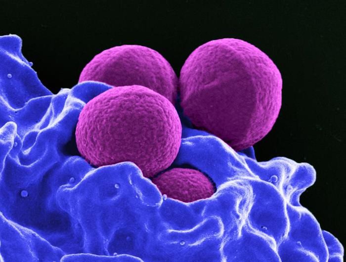 A digitally colorized SEM image of (magenta) methicillin-resistant, Staphylococcus aureus (MRSA) bacteria in the process of being phagocytized by a (blue) neutrophil. / Credit: National Institute of Allergy and Infectious Diseases (NIAID)