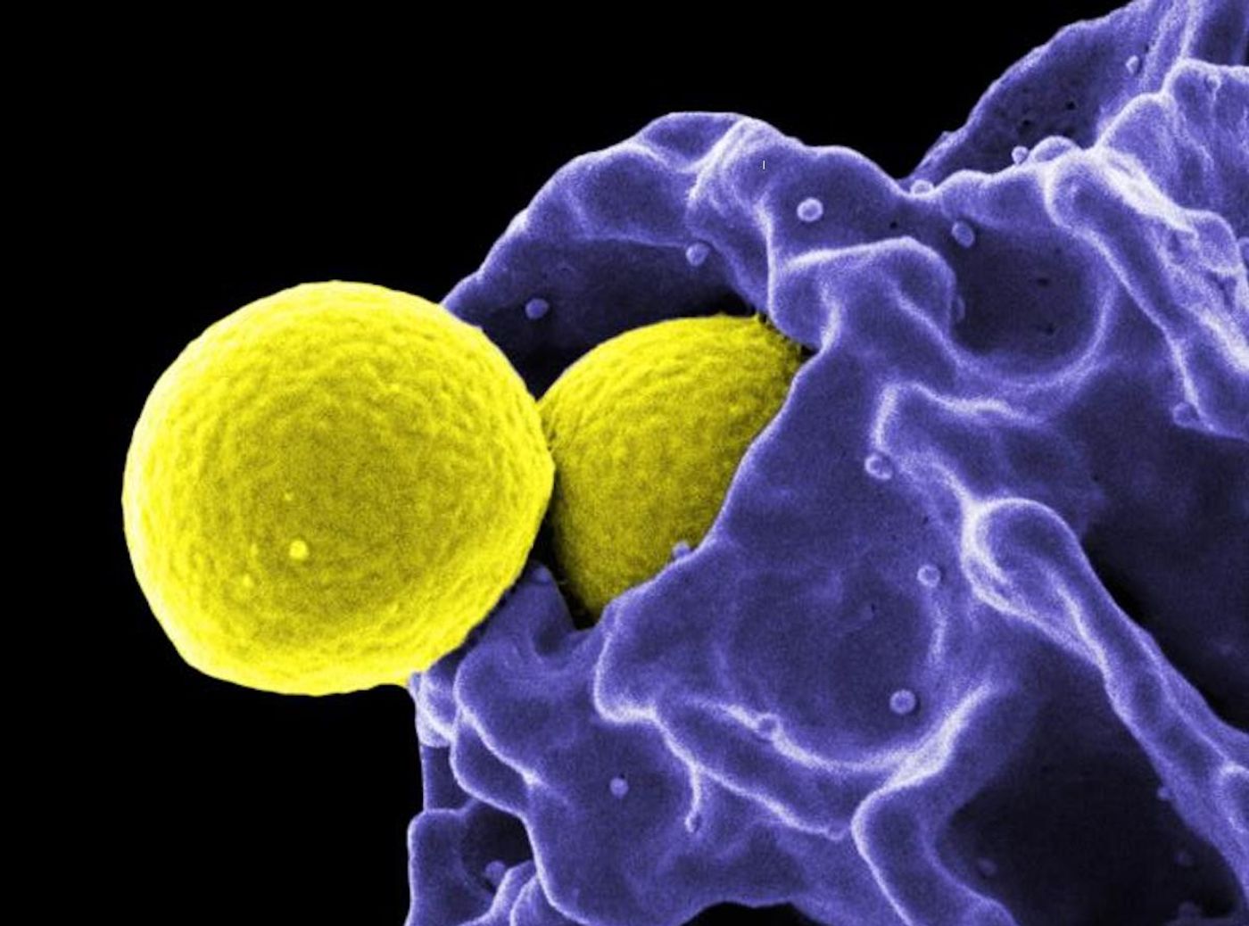 This SEM image by National Institute of Allergy and Infectious Diseases (NIAID) depicts two, yellow Staphylococcus aureus (MRSA) bacteria being phagocytized by a blue-colored neutrophil. / Credit: National Institute of Allergy and Infectious Diseases (NIAID)