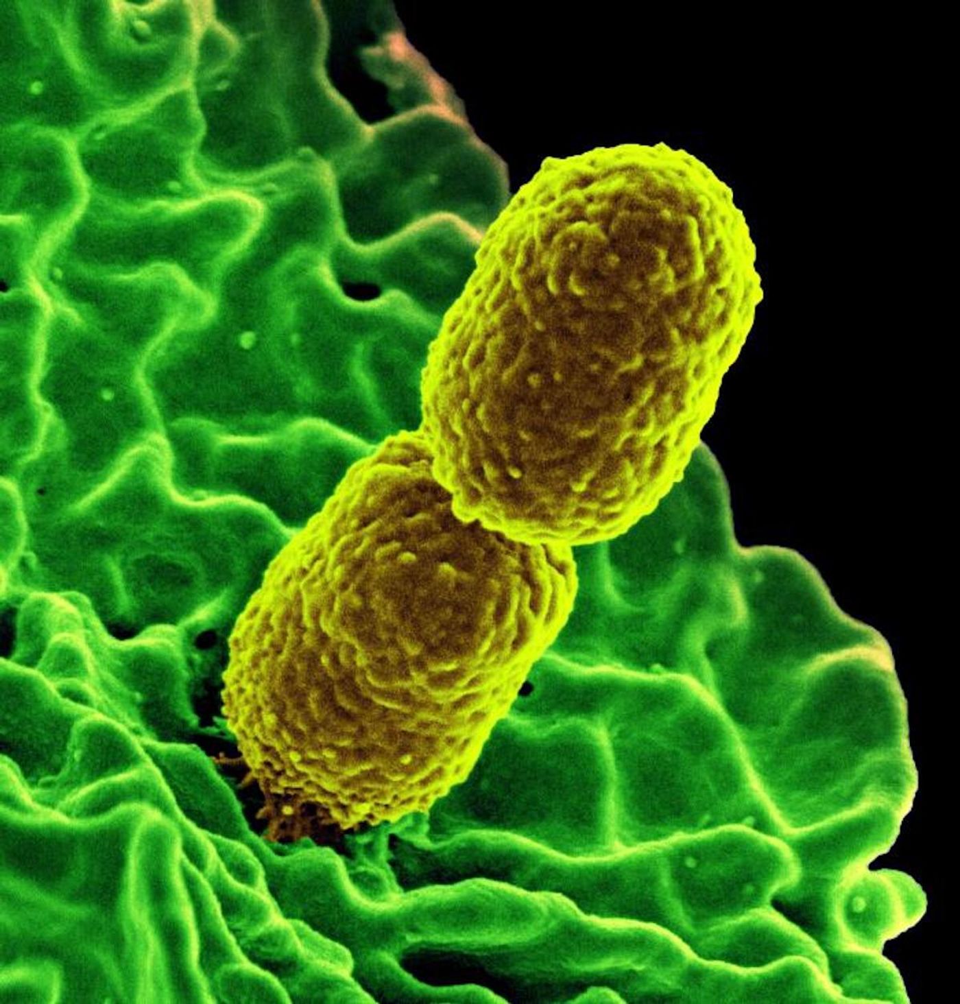 A digitally colorized SEM image of two carbapenem-resistant Klebsiella pneumoniae (CRKP) bacteria (yellow) interacting with a type of human white blood cell called a neutrophil (green) / Credit: National Institute of Allergy and Infectious Diseases (NIAID)