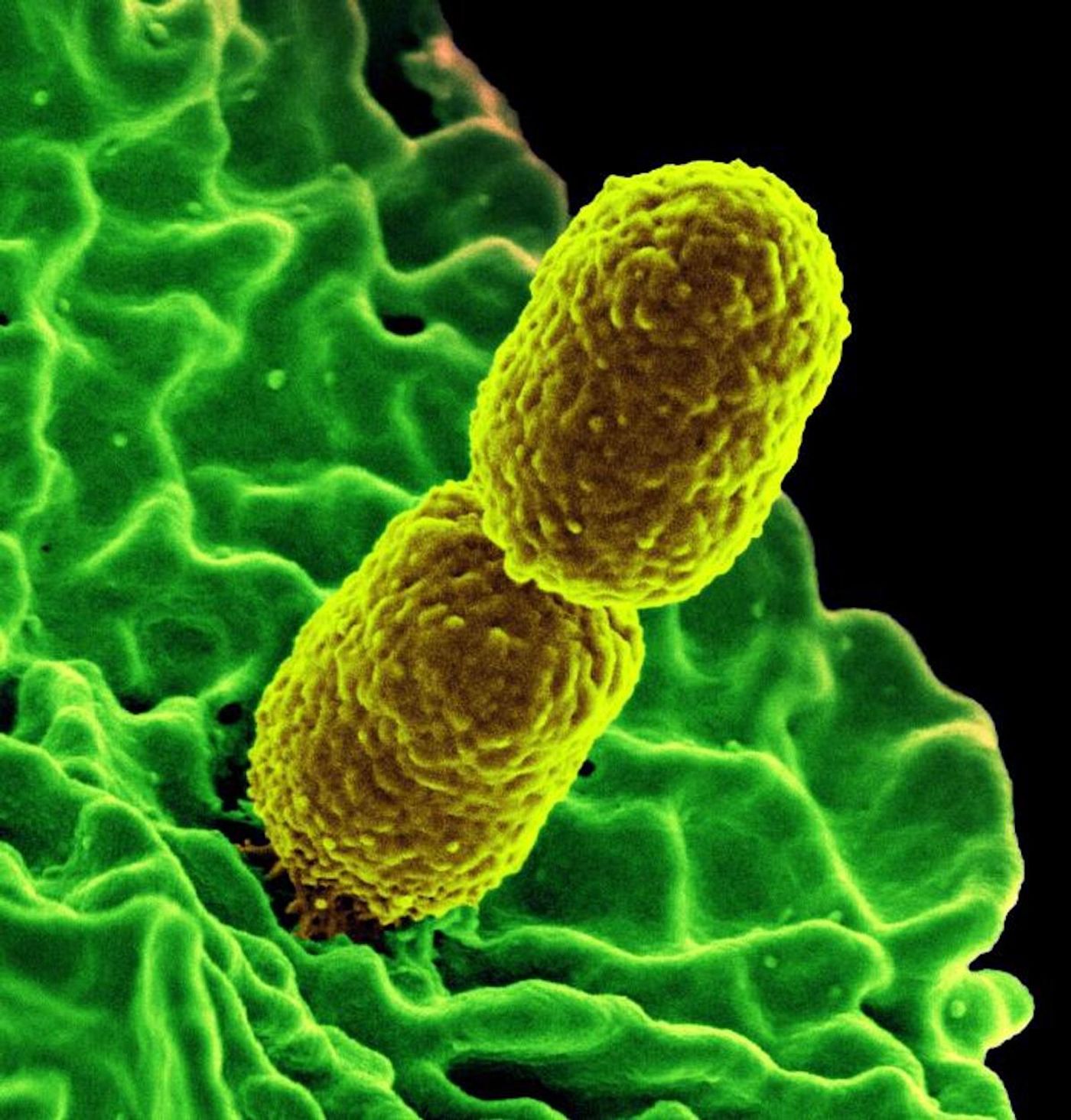 A National Institute of Allergy and Infectious Diseases (NIAID) digitally colorized SEM image of two carbapenem-resistant Klebsiella pneumoniae bacteria (yellow) interacting with a neutrophil (green) / Credit: National Institute of Allergy and Infectious Diseases (NIAID)