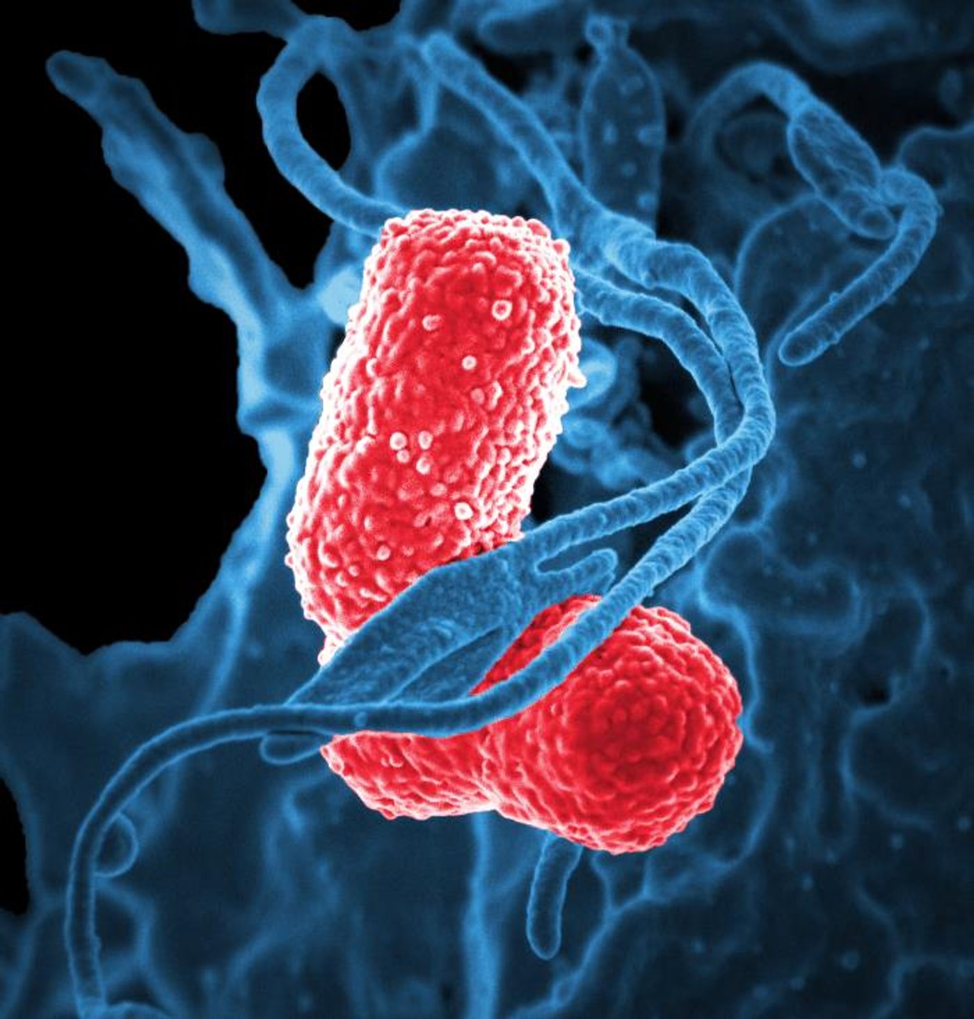 A digitally colorized SEM image, of a human white blood cell, (blue) interacting with two multidrug-resistant Klebsiella pneumoniae bacteria (pink), which are known to cause severe hospital acquired, nosocomial infections. / Credit: National Institute of Allergy and Infectious Diseases (NIAID) / David Dorward, PhD