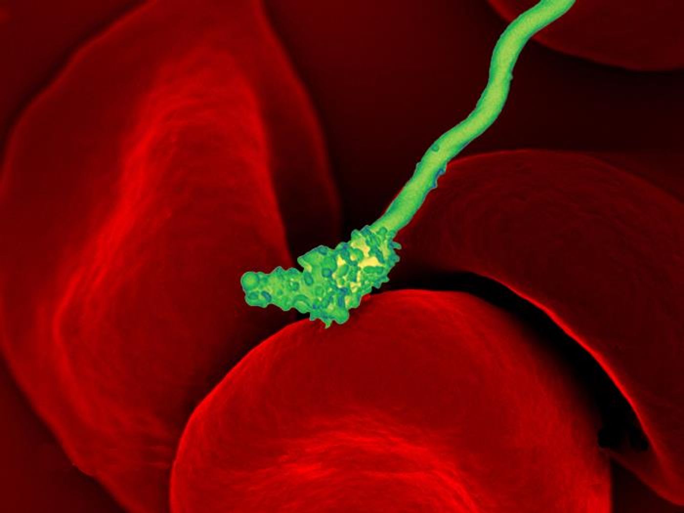 A digitally colorized SEM image of a green-colored, spiral shaped, Borrelia hermsii bacterium, atop a number of red-colored red blood cells (RBCs). B. hermsii is the causative agent of tick-borne relapsing fever. / Credit: National Institute of Allergy and Infectious Diseases (NIAID)