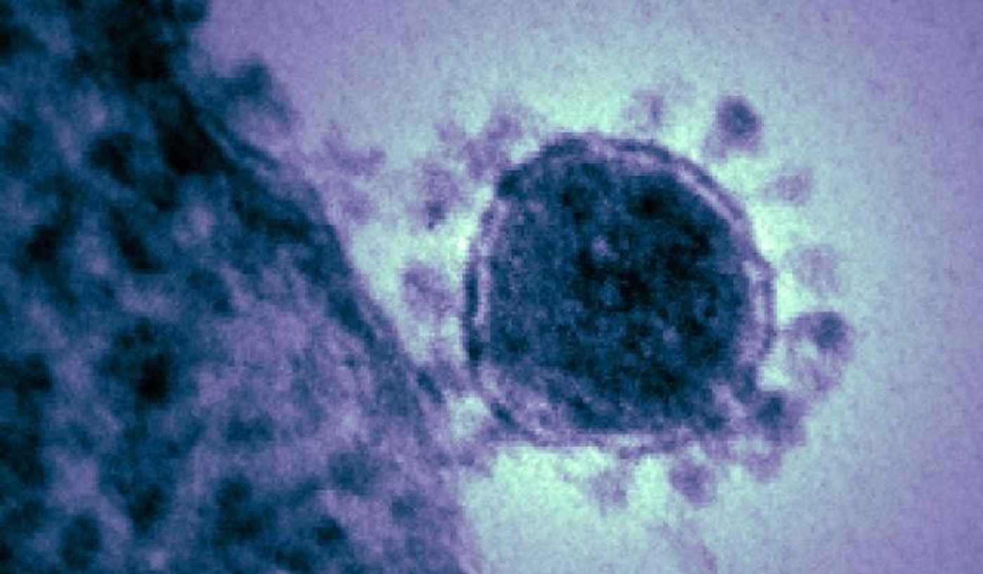 A highly magnified, digitally colorized TEM image shows a single, spherical shaped, Middle East respiratory syndrome coronavirus (MERS-CoV) virion. / Credit: National Institute of Allergy and Infectious Diseases (NIAID)