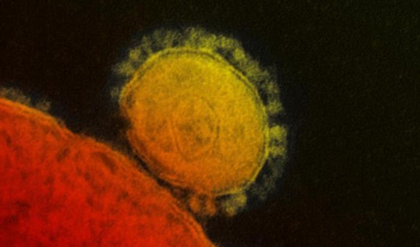 A highly magnified, digitally colorized TEM image revealing ultrastructural details of a single, spherical shaped, Middle East respiratory syndrome coronavirus (MERS-CoV) virion. / Credit: National Institute of Allergy and Infectious Diseases