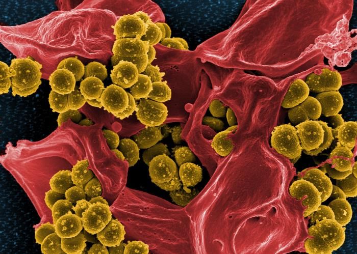 芥末色耐甲氧西林金黄色葡萄球菌(MRSA)的数字化彩色扫描电镜图像，它被包裹在红色的人类白细胞中。国家过敏和传染病研究所(NIAID)