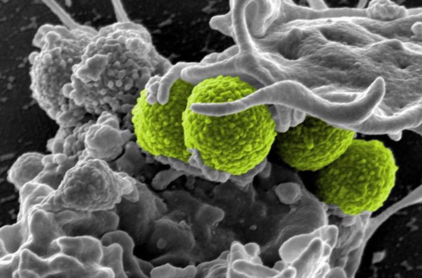 An SEM image of methicillin-resistant, Staphylococcus aureus (MRSA) bacteria (green), as they were being enveloped by a human white blood cell. / Credit: CDC/National Institute of Allergy and Infectious Diseases (NIAID)