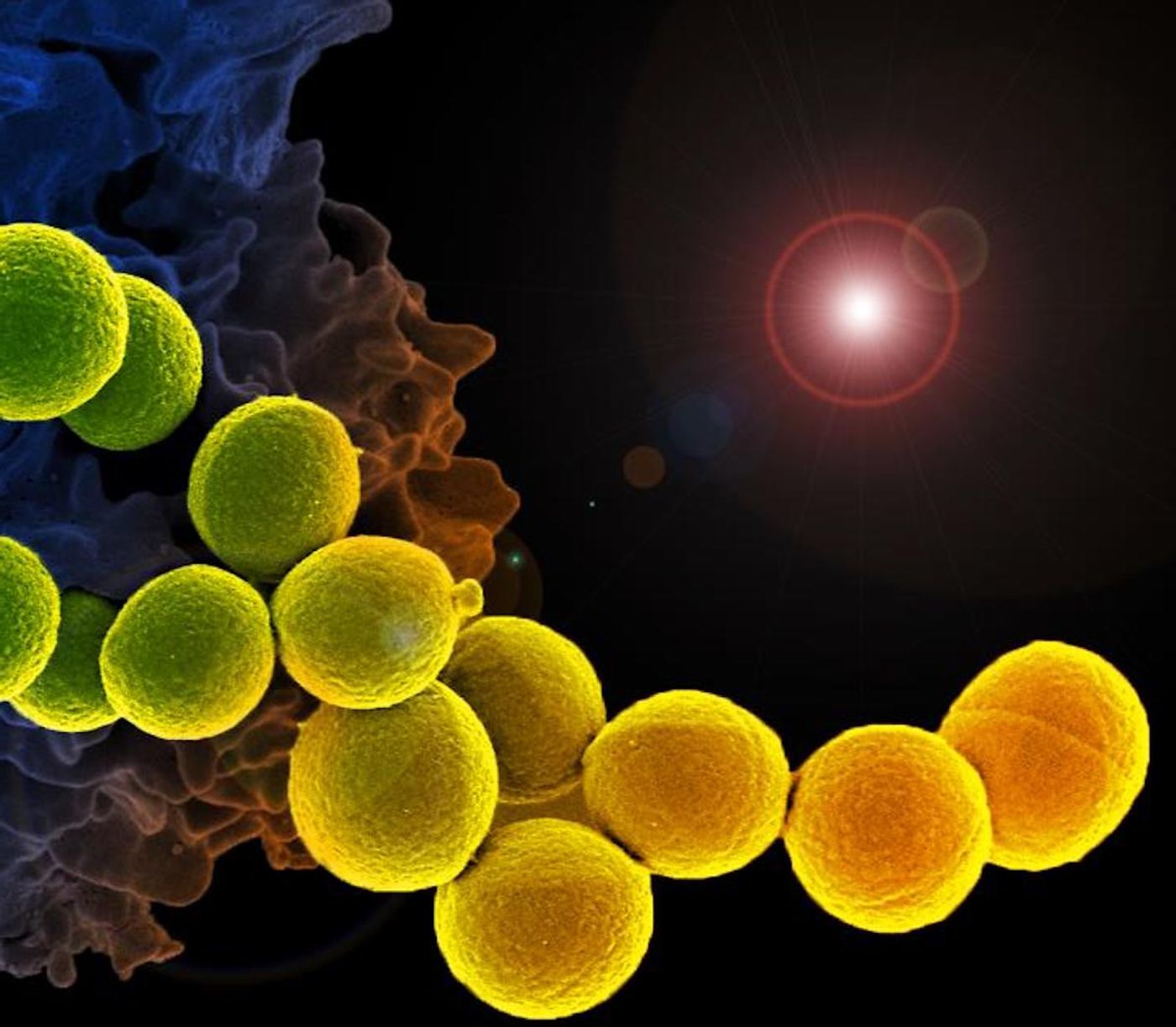 A digitally colorized, scanning electron microscopic image depicting spheroid, MRSA bacteria (yellow) in the process of being ingested by a white blood cell known as a neutrophil, (blue). / Credit: National Institute of Allergy and Infectious Diseases