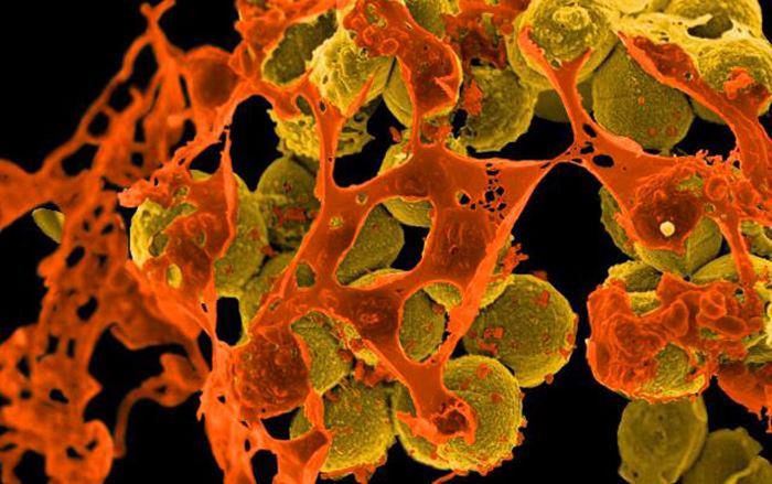 A digitally colorized SEM image of mustard-colored, methicillin-resistant, Staphylococcus aureus (MRSA) bacteria, surrounded by orange-colored cellular debris./ Credit: National Institute of Allergy and Infectious Diseases (NIAID)