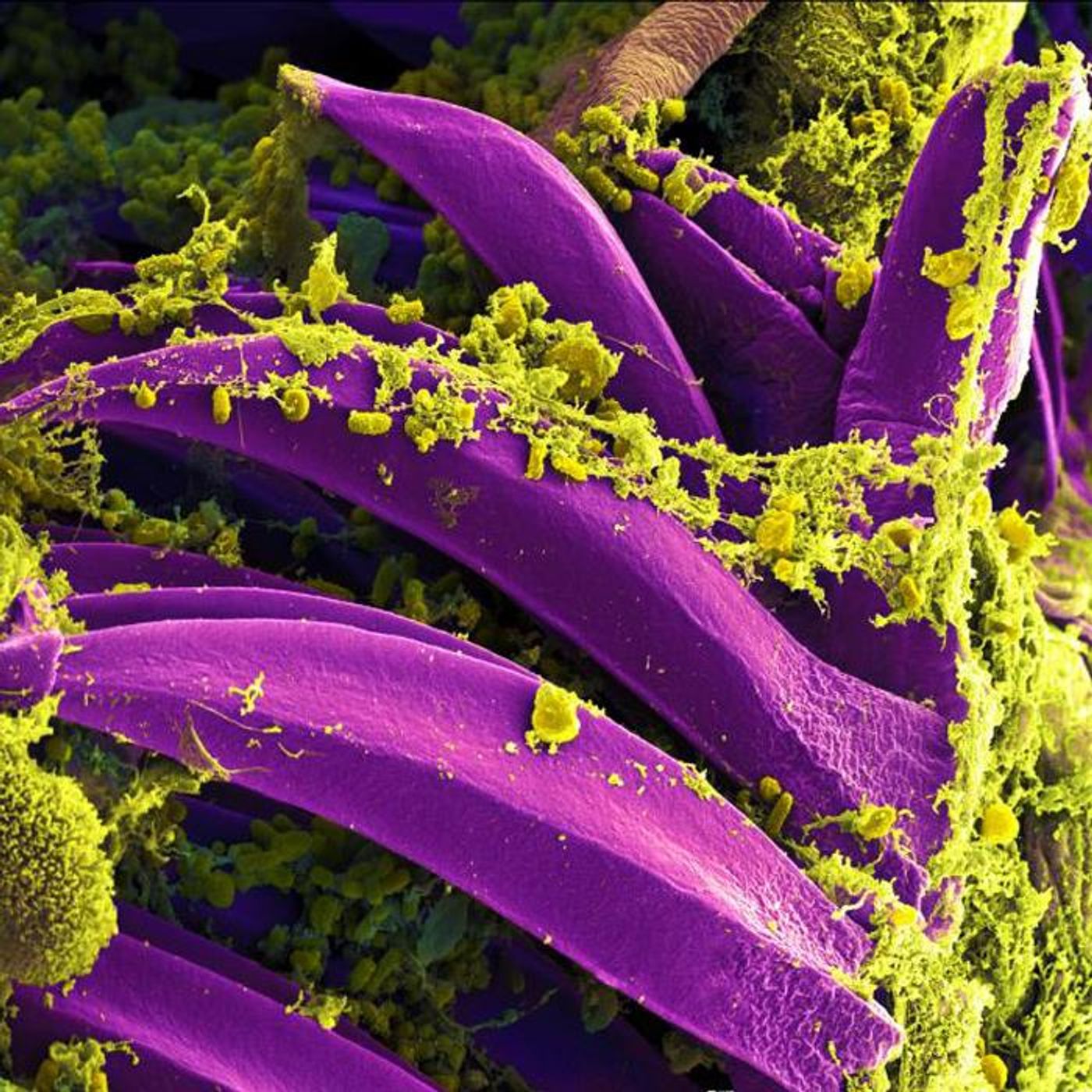 By National Institute of Allergy and Infectious Diseases (NIAID), this digitally colorized SEM image depicts yellow-colored, Yersinia pestis bacteria gathered on the spines of a flea. / Credit: NIAID