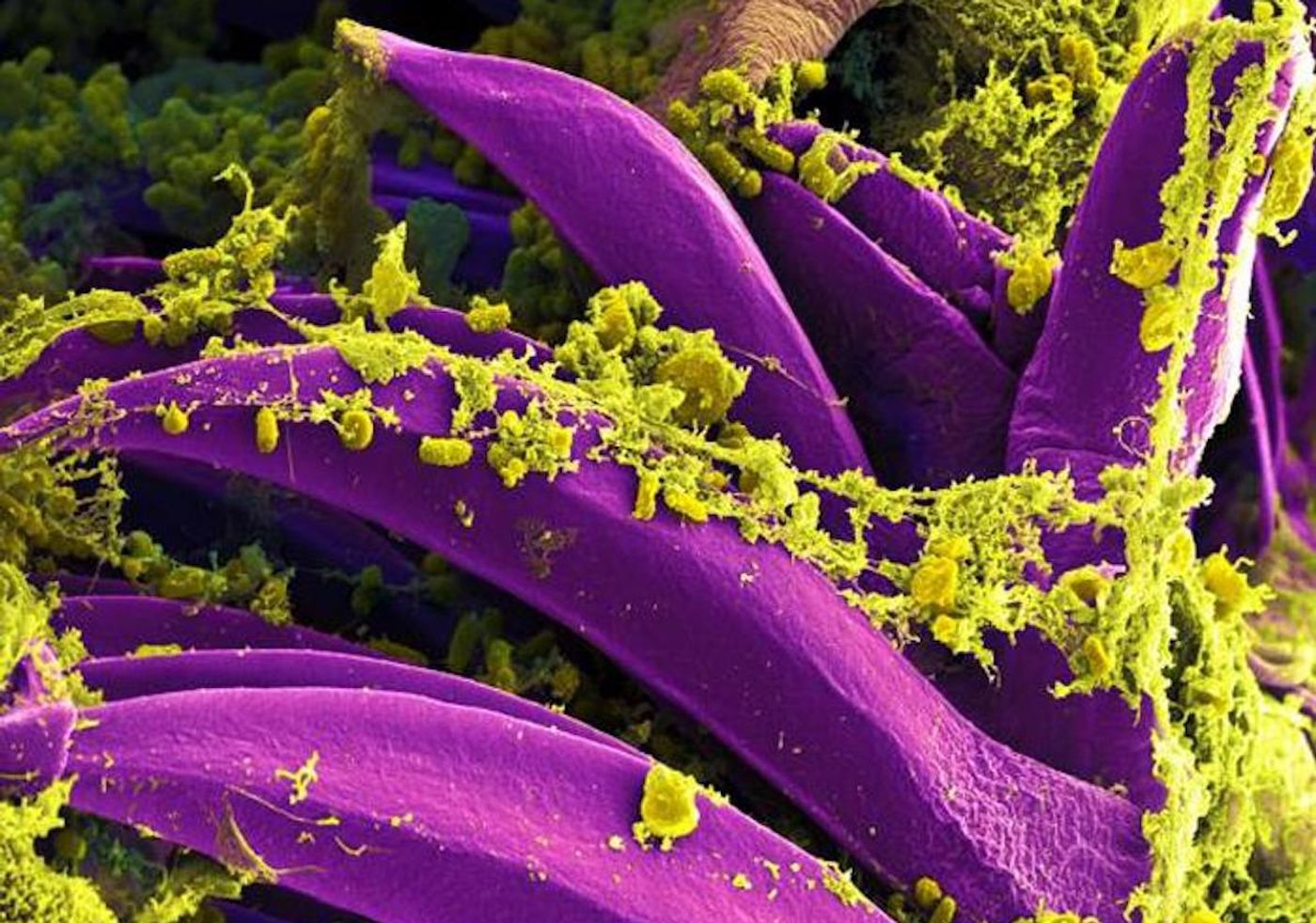 A digitally colorized SEM image of yellow-colored, Yersinia pestis bacteria gathered on the proventricular spines of a Xenopsylla cheopis flea. These spines are found in the interior of a part of the flea's digestive system. / Credit: National Institute of Allergy and Infectious Diseases (NIAID)