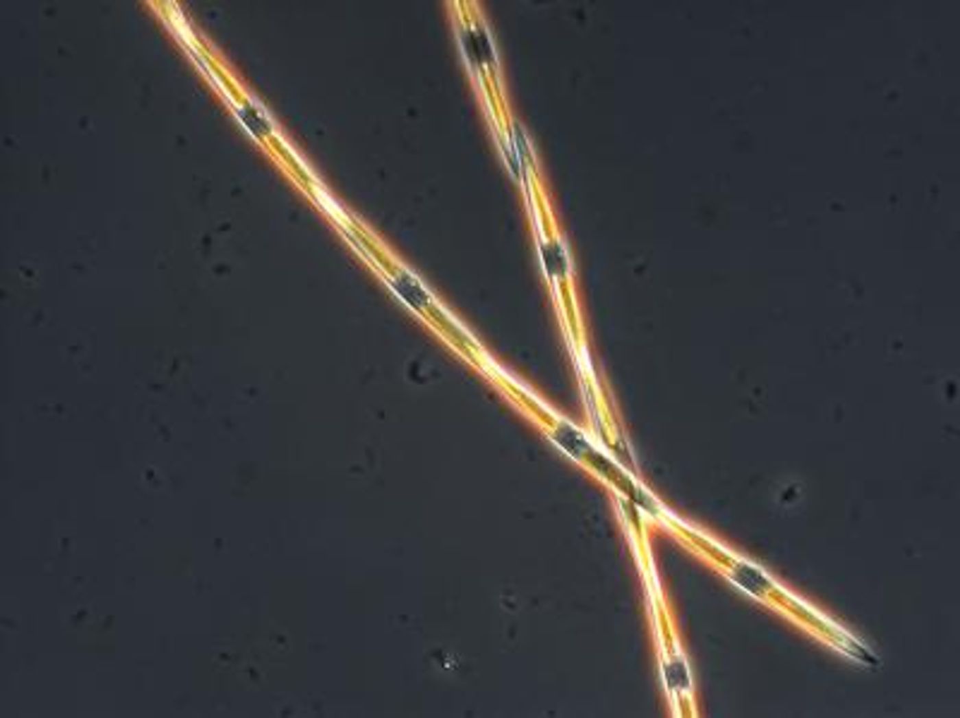This is a microscopic view of domoic acid producing Pseudo-nitzschia diatom in a seawater sample from Monterey Bay, Calif. This diatom species, when in active growth typically typically forms long chains of individual cells. / Credit: G. Jason Smith at Moss Landing Marine Labs.