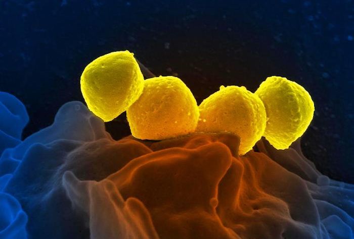 (Cropped) A digitally colorized SEM image of four Group A Streptococcus (yellow), Streptococcus pyogenes bacteria, atop the surface of a human white blood cell / Credit: National Institute of Allergy and Infectious Diseases (NIAID)