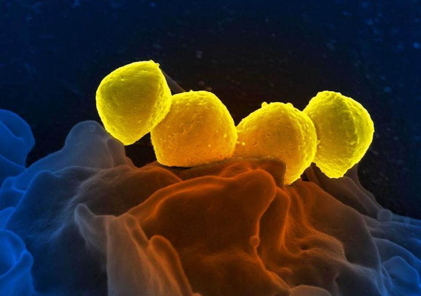 Digitally colorized scanning electron microscopic image depicting four, yellow colored, Group A Streptococcus, Streptococcus pyogenes bacteria, atop the surface of a human white blood cell / Credit: National Institute of Allergy and Infectious Diseases