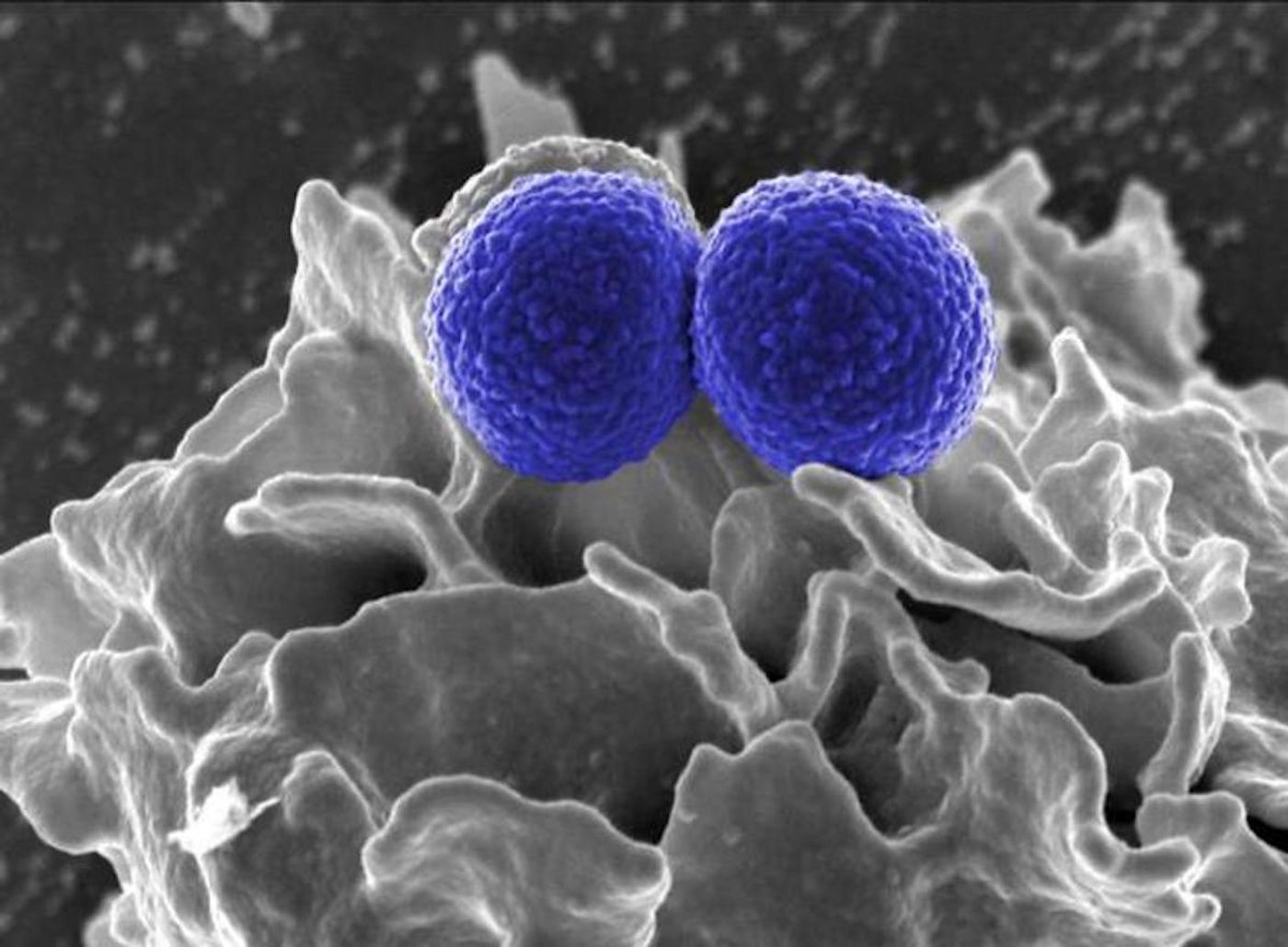 Two blue-colored, spherical, methicillin-resistant, Staphylococcus aureus (MRSA) bacteria in the process of being phagocytized by an uncolored, human white blood cell (WBC). / Credit: National Institute of Allergy and Infectious Diseases (NIAID)