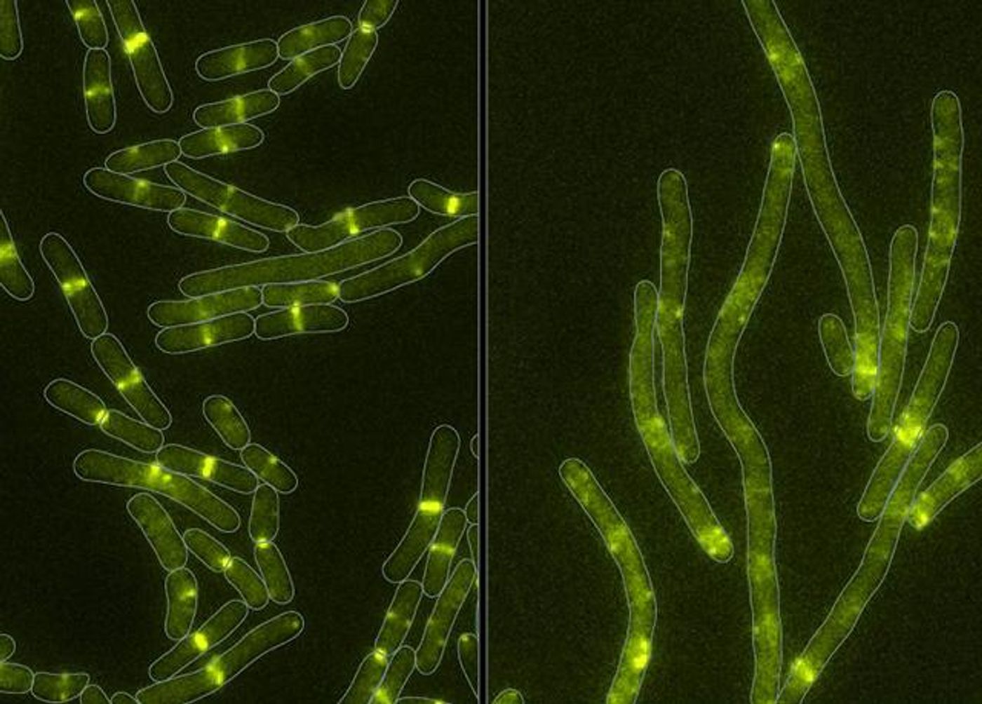Healthy cells (left) and cells under attack by the newly discovered toxin (right). The protein targeted by the toxin is labeled with green fluorescent protein. The toxin disrupts the structure made by this protein at the center of the cell. Without this structure, cells cannot divide. Instead, they grow longer until eventually they break apart and die.  / Credit: Mougous Lab/UW Medicine