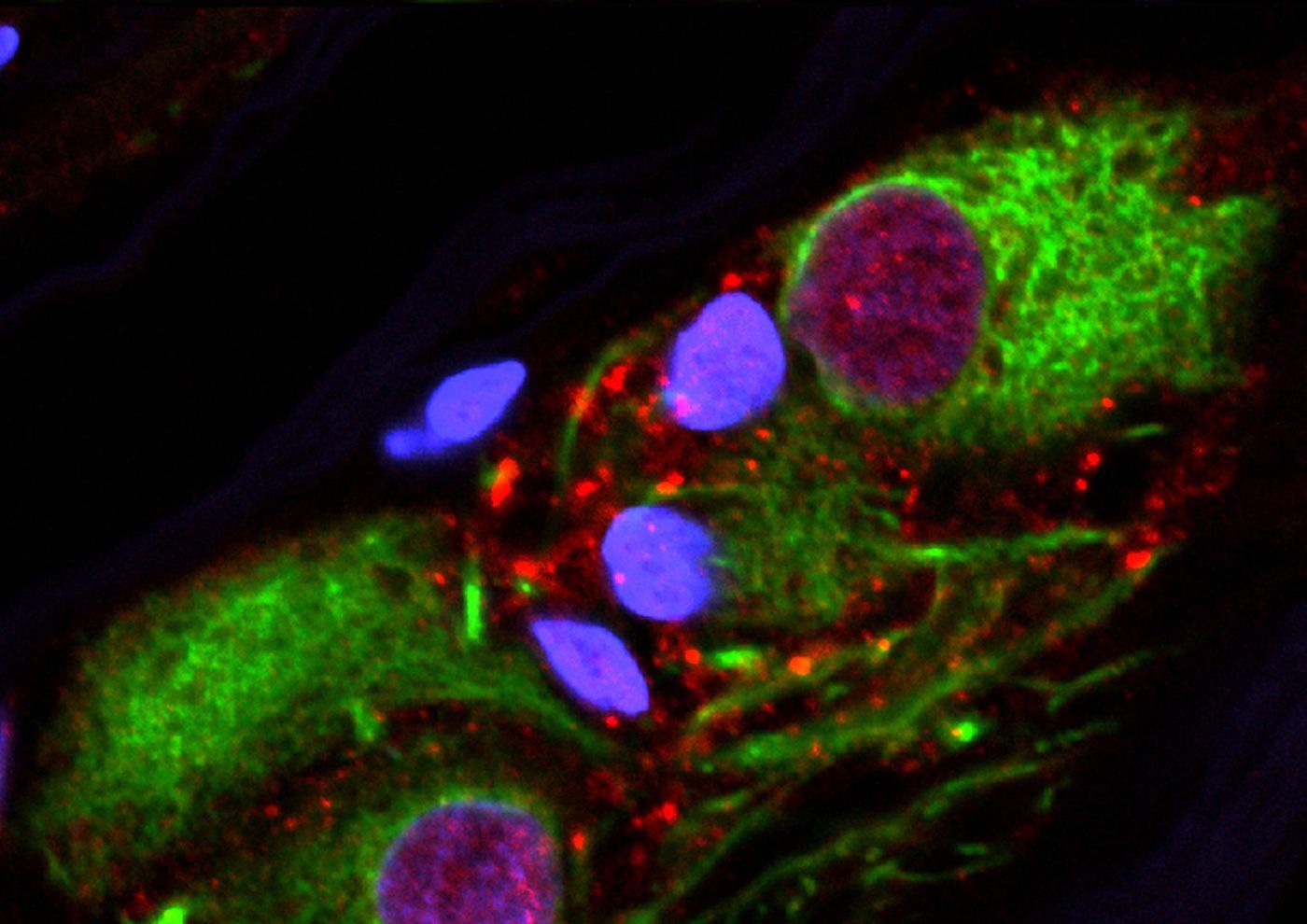 Aggregated alpha-synuclein in the neurons of the appendix. / Credit: Courtesy of Viviane Labrie | Van Andel Research Institute