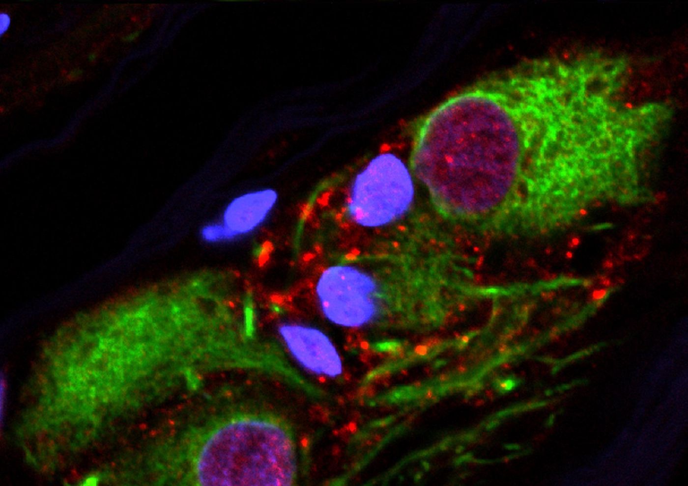 Aggregated alpha-synuclein in the neurons of the appendix. / Credit: Courtesy of Viviane Labrie | Van Andel Research Institute