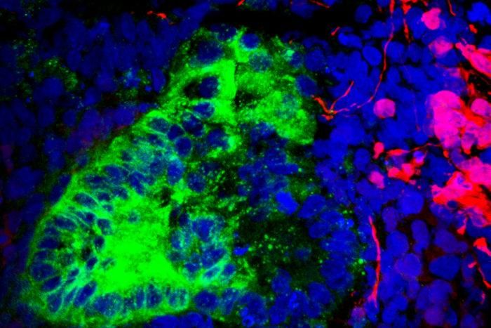 Rogue cells lurk in a kidney organoid. The image shows brain neurons in red and kidney cells in green./ Credit: Humphreys lab