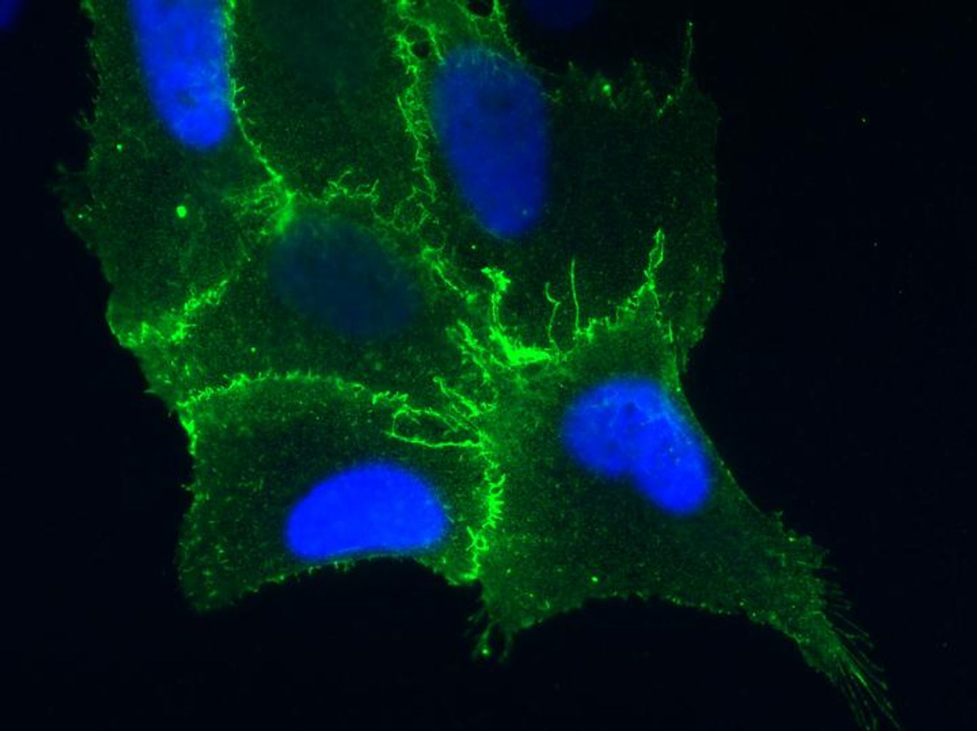 This cell from the lining of the lung is expressing the protein receptor PCDH1 (in blue), which is found on cell membranes. / Credit: Albert Einstein College of Medicine
