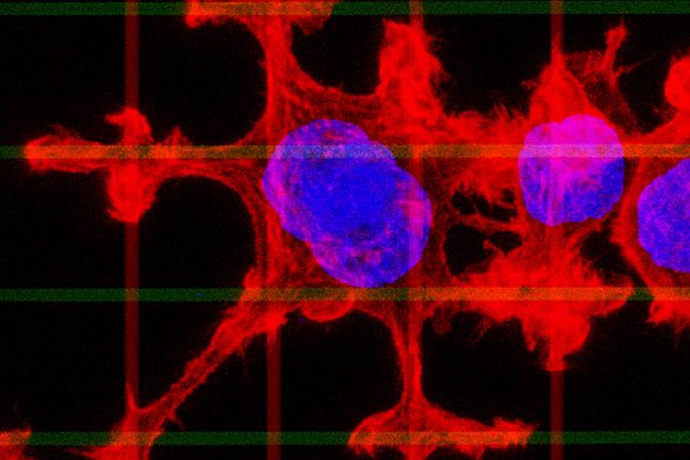 After targeting the "motors" that generate forces in cancer cells to move, the cancer cells switch to a dendritic or "flowing" response to follow pathways in tumors that drive cell migration and promote spreading of the cancer. / Credit: Tabdanov/Provenzano, University of Minnesota